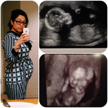 2nd Pregnancy - 16 Weeks